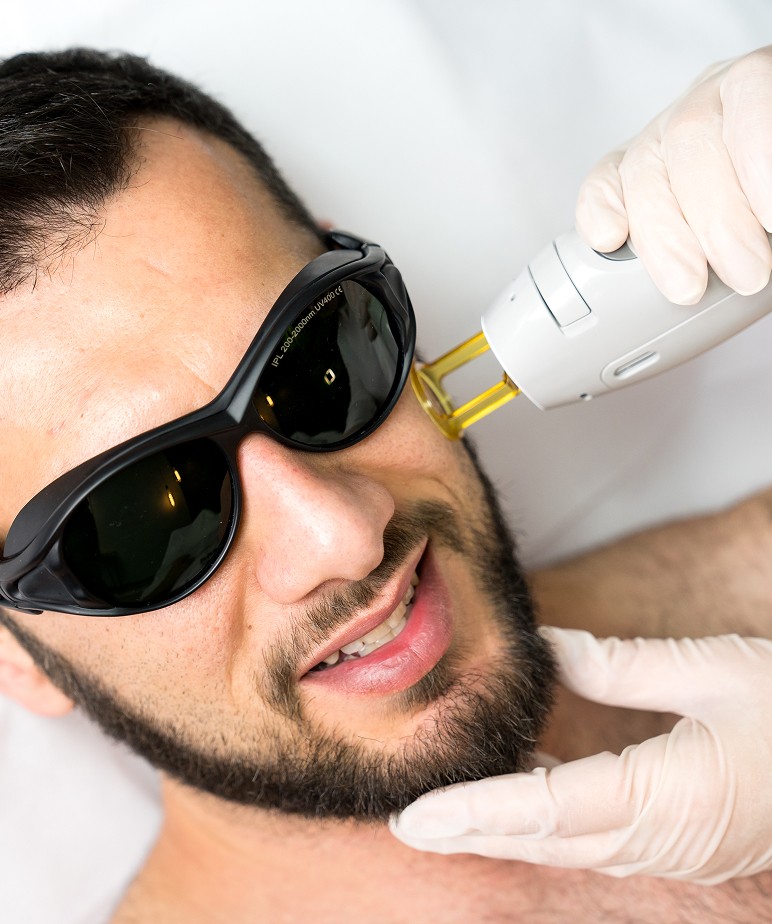 Мужская Александритовая лазерная эпиляция бороды (2)