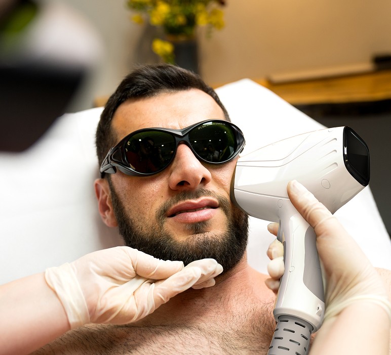 Мужская лазерная эпиляция бороды и лица (1)